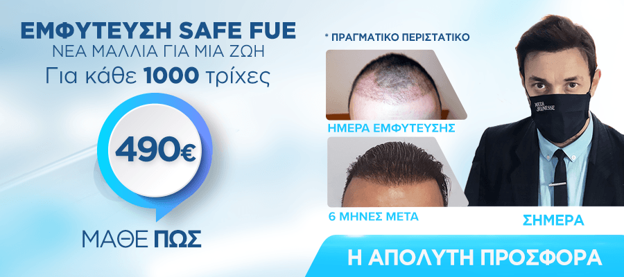 Εμφύτευση Safe FUE 1000 ΤΡΙΧΕΣ-490€