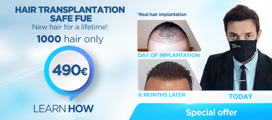 Hair Transplantation Safe FUE 1000 HAIR-490€