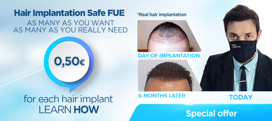 Hair Transplantation SAFE FUE 0,50€ / HAIR IMPLANT