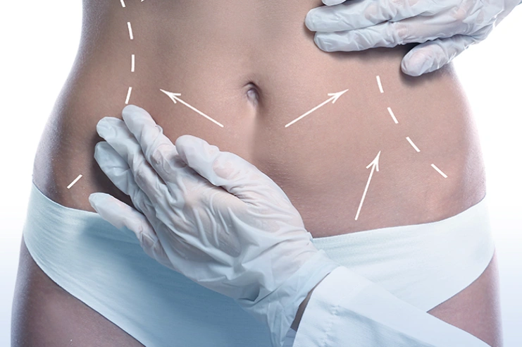 Ιατρική αισθητική σώματος Header Image